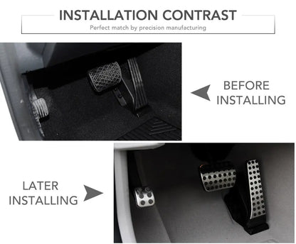 Pédales d'Accélérateur et de Frein Antidérapantes en Acier Inoxydable, pour Mercedes Benz Classe GLC X253 C253 2016 2017 2018 2019 2020 2021 2022